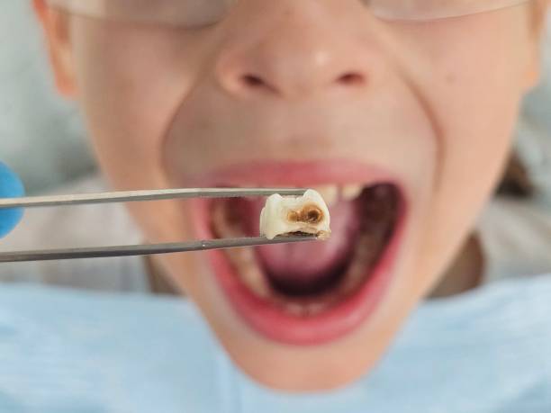 Best Same-Day Emergency Dentist in Port Oconnor, TX